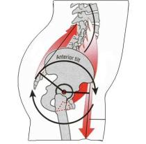 anterior pelvic tilt and lordosis